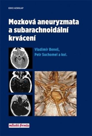 Kniha: Mozková aneurysmata a subarachnoidální krvácení - 1. vydanie - Vladimír Beneš