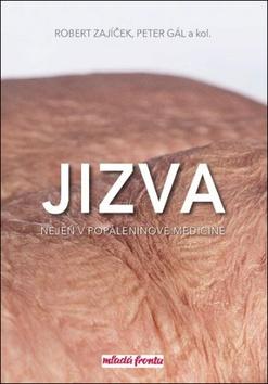 Kniha: Jizva nejen v popáleninové medicíně - 1. vydanie - Robert Zajíček; Peter Gál
