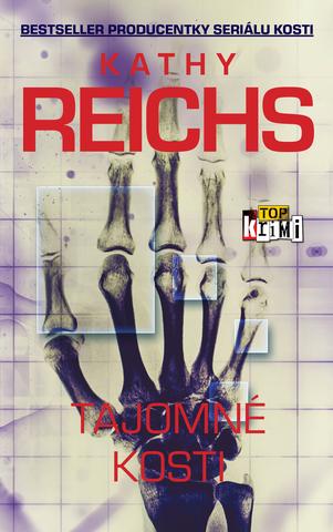 Kniha: Tajomné kosti - Kathy Reichs