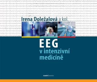 Kniha: EEG v intenzivní medicíně - 1. vydanie - Irena Doležalová a kol.