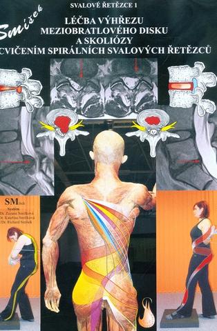 Kniha: Léčba výhřezu meziobratlového disku a skoliózy cvičením spirálních svalových řetězců - Richard Smíšek