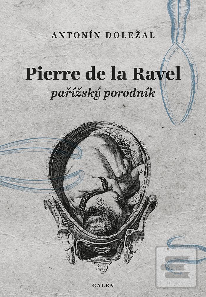 Kniha: Pierre de la Ravel, pařížský porodník - pařížský podvodník - 2. vydanie - Antonín Doležal