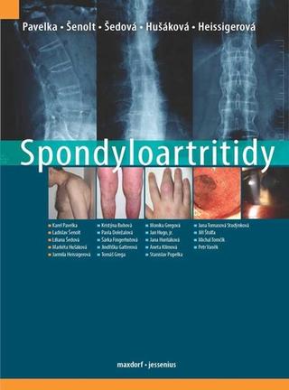 Kniha: Spondyloartritidy - 1. vydanie - Karel Pavelka; Ladislav Šenolt; Liliana Šedová