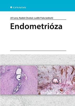 Kniha: Endometrióza - 1. vydanie - Luděk Fiala