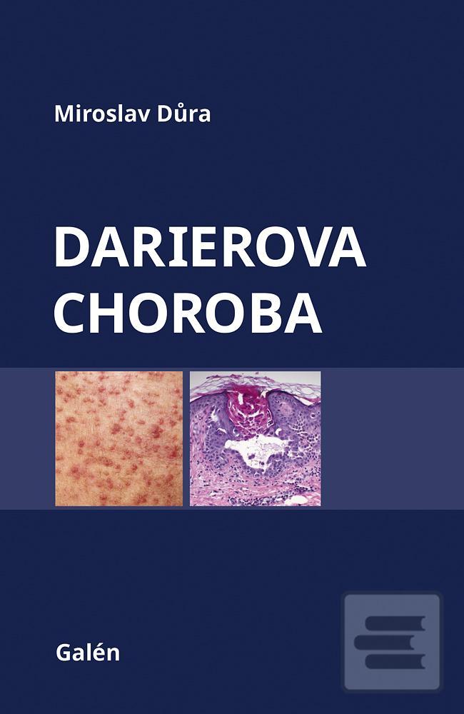 Kniha: Darierova choroba - 1. vydanie - Miroslav Důra
