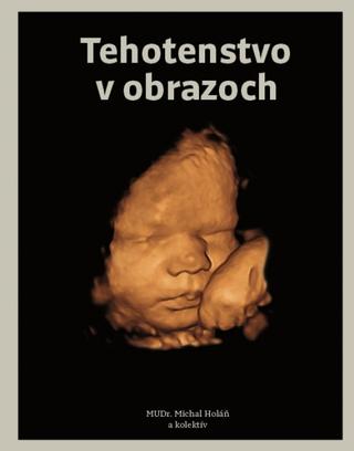 Kniha: Tehotenstvo v obrazoch - 1. vydanie - Michal Holáň a kolektív