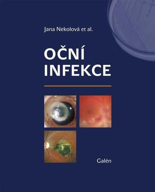 Kniha: Oční infekce - 1. vydanie - Jana Nekolová