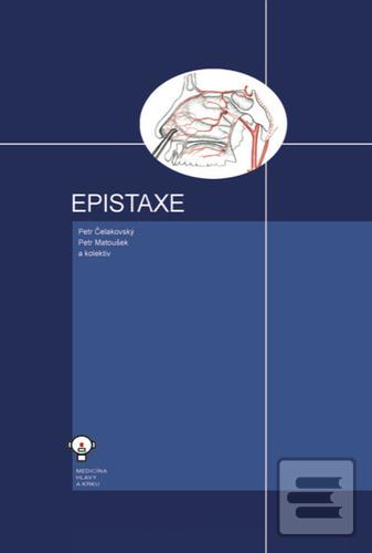 Epistaxe (Petr Čelakovský; Petr Matoušek)