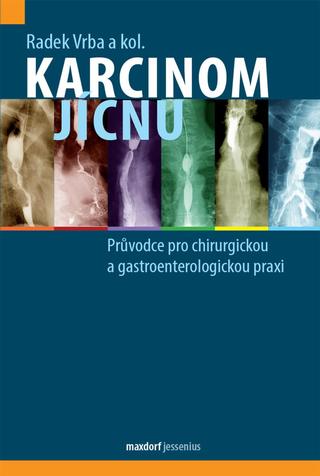 Kniha: Karcinom jícnu - Průvodce pro chirurgickou a gastroenterologickou praxi - Průvodce pro chirurgickou a gastroenterologickou praxi - 1. vydanie - Radek Vrba