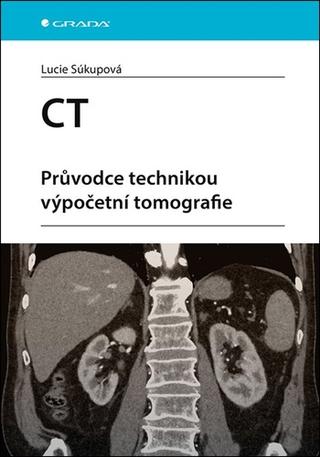 Kniha: CT - Průvodce technikou výpočetní tomografie - 1. vydanie - Lucie Súkupová