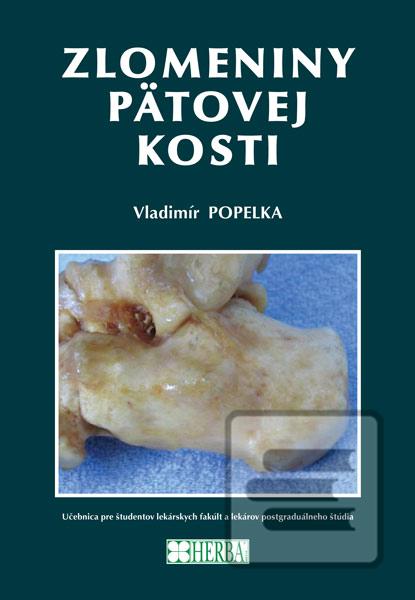 Zlomeniny pätovej kosti (Vladimír Popelka)