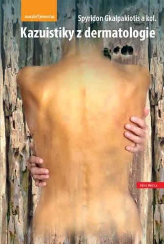 Kniha: Kazuistiky z dermatologie - 1. vydanie - Spyridon Gkalpakiotis