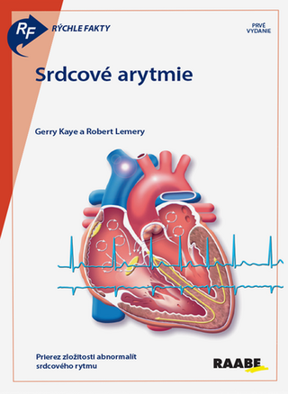 Kniha: Srdcové arytmie - 1. vydanie - Gerry Kaye; Robert Lemery