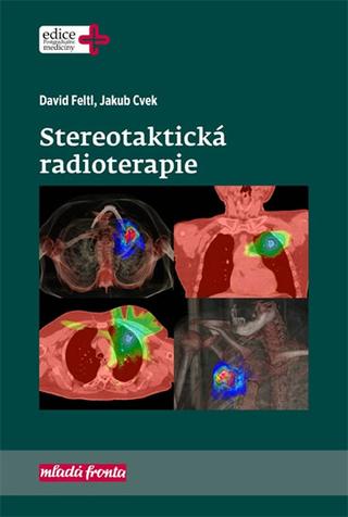 Kniha: Stereotaktická radioterapie - 1. vydanie - David Feltl; Jakub Cvek
