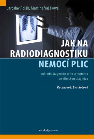 Kniha: Jak na radiodiagnostiku nemocí plic - od radiodiagnostického symptomu po klinickou diagnózu - 1. vydanie - Jaroslav Polák