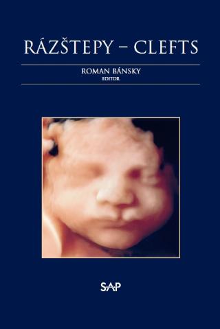 Kniha: Rázštepy-Clefts - Roman Bánsky