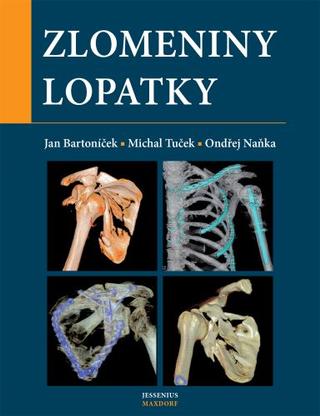 Kniha: Zlomeniny lopatky - 1. vydanie - Ondřej Naňka