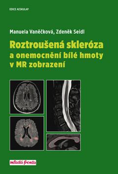 Kniha: Roztroušená skleróza a onemocnění bílé hmoty v MR zobrazení - 1. vydanie - Zdeněk Seidl