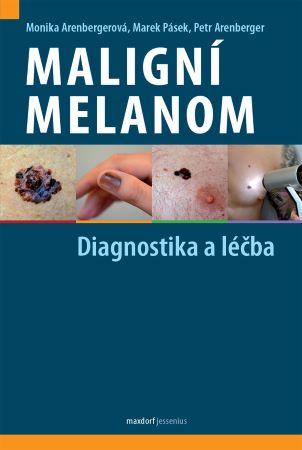 Kniha: Maligní melanom - Diagnostika a léčba - 1. vydanie - Monika Arenbergerová