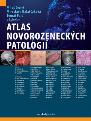 Kniha: Atlas novorozeneckých patologií - 1. vydanie - Miroslava Balaščaková; Miloš Černý; Tomáš Fait