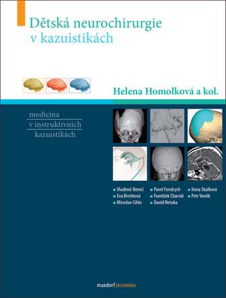 Kniha: Dětská neurochirurgie v kazuistikách - 1. vydanie - Helena Homolková