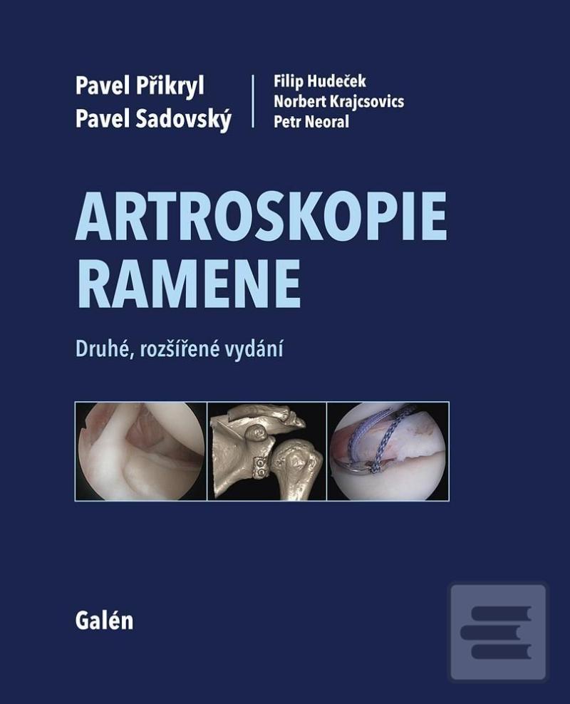 Kniha: Artroskopie ramene - 2. vydanie - Pavel Přikryl; Pavel Sadovský; Filip Hudeček