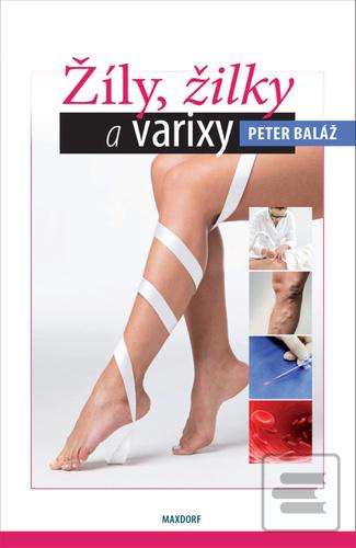 Kniha: Žíly, žilky a varixy - 1. vydanie - Peter Baláž