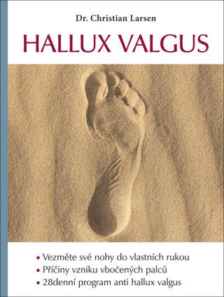 Kniha: Hallux valgus - 1. vydanie - Christian Larsen