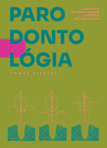 Kniha: Parodontológia - Doc. MUDR. Tomáš Siebert, PhD