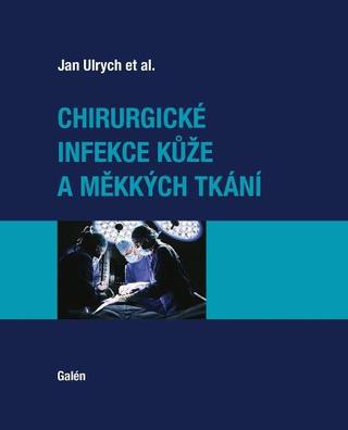 Kniha: Chirurgické infekce kůže a měkkých tkání - 1. vydanie - Jan Ulrych