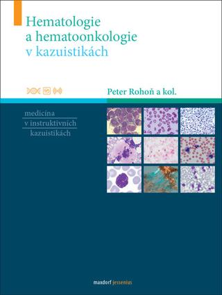 Kniha: Hematologie a hematoonkologie v kazuistikách - Medicína v instruktivních kazuistikách - 1. vydanie - Peter Rohoň