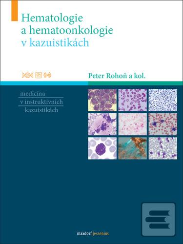 Hematologie a hematoonko… (Peter Rohoň)