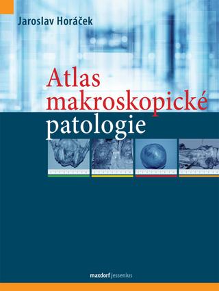 Kniha: Atlas makroskopické patologie - 1. vydanie - Jaroslav Horáček