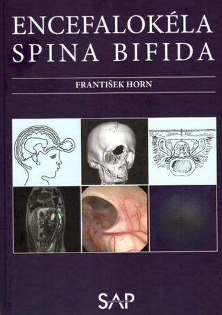 Kniha: Encefalokéla spina bifida - František Horn