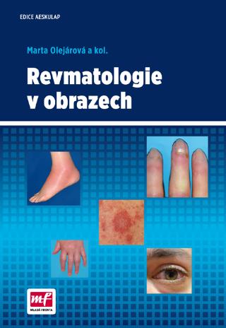 Kniha: Revmatologie v obrazech - 1. vydanie - Marta Olejárová