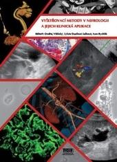 Kniha: Vyšetřovací metody v nefrologii a jejich klinická aplikace - Ondřej Viklický