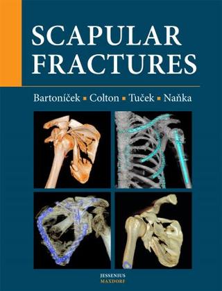 Kniha: Scapular fractures - 1. vydanie - Jan Bartoníček