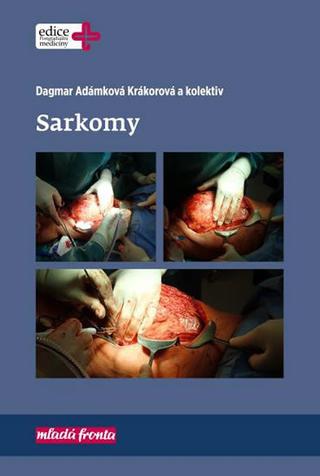 Kniha: Sarkomy - 1. vydanie - Dagmar Adámková Krákorová