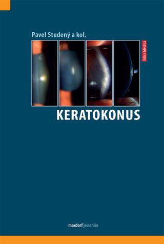 Kniha: Keratokonus - 1. vydanie - Pavel Studený