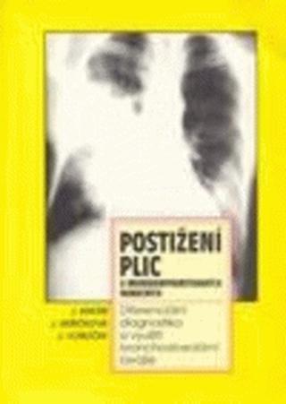 Kniha: Postižení plic u imunokompromitovaných nemocných - Diferenciální diagnostika a využití bronchoaveolární laváže - Jiří Vorlíček, Jiří Mayer