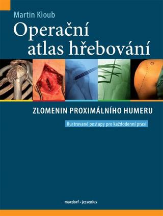 Kniha: Operační atlas hřebování zlomenin proximálního humeru - Ilustrované postupy pro každodenní praxi - 1. vydanie - Martin Kloub