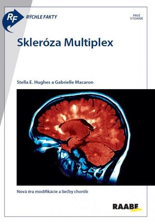 Kniha: Rýchle fakty : Skleróza multiplex - Nová éra modifikácie a liečby chorôb - 1. vydanie - Gabrielle Macaron; Stella E. Hughes