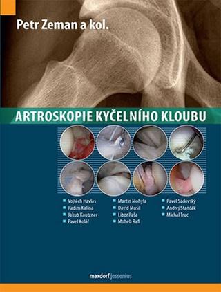 Kniha: Artroskopie kyčelního kloubu - 1. vydanie - Petr Zeman