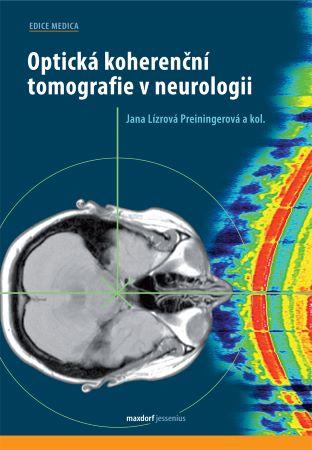 Kniha: Optická koherenční tomografie v neurologii - Jana Lízrová Preiningerová