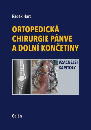 Kniha: Ortopedická chirurgie pánve a dolní končetiny - Vzácnější kapitoly - 1. vydanie - Radek Hart