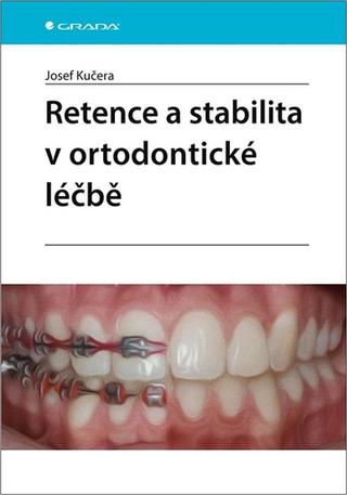 Kniha: Retence a stabilita v ortodontické léčbě - 1. vydanie - Josef Kučera
