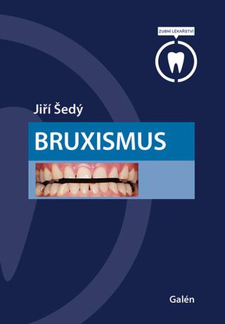 Kniha: Bruxismus - 1. vydanie - Jiří Šedý