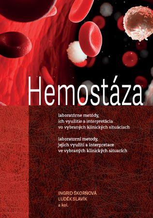 Kniha: Hemostáza - laboratorní metody, jejich využití a interpretace ve vybraných klinických situacích - Ingrid Škorňová