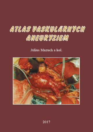 Kniha: Atlas vaskulárnych aneuryziem - Július Mazuch