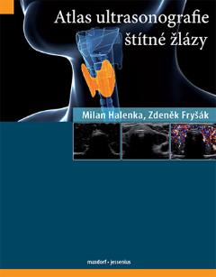 Kniha: Atlas ultrasonografie štítné žlázy - Zdeněk Fryšák